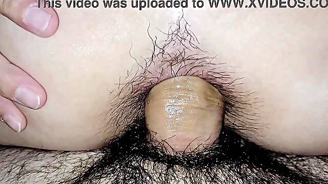 Quick anal