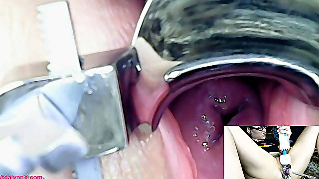 AdalynnX - Endoscope Speculum Hitachi Vibrator Cum